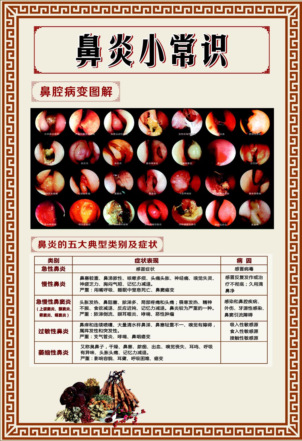 m768鼻腔鼻炎小常识鼻腔病变图解1451海报印制展板写真喷绘贴纸