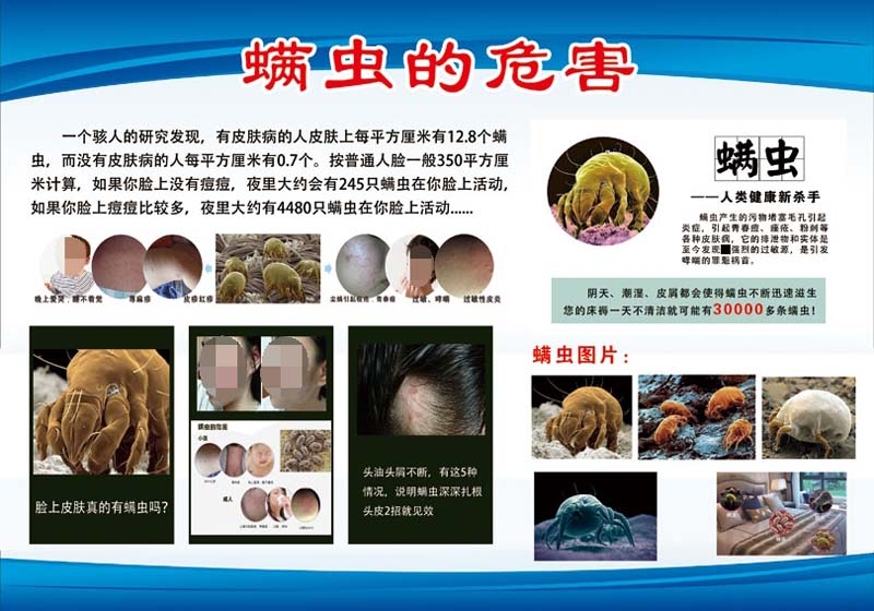 m769螨虫对人体的危害造成的影响身体产生的症状海报印制展板2617