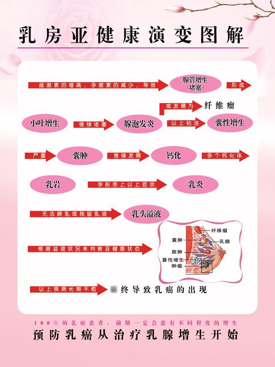 m769关爱乳房亚健康演变图解进程变化1168海报定制印制展板墙贴