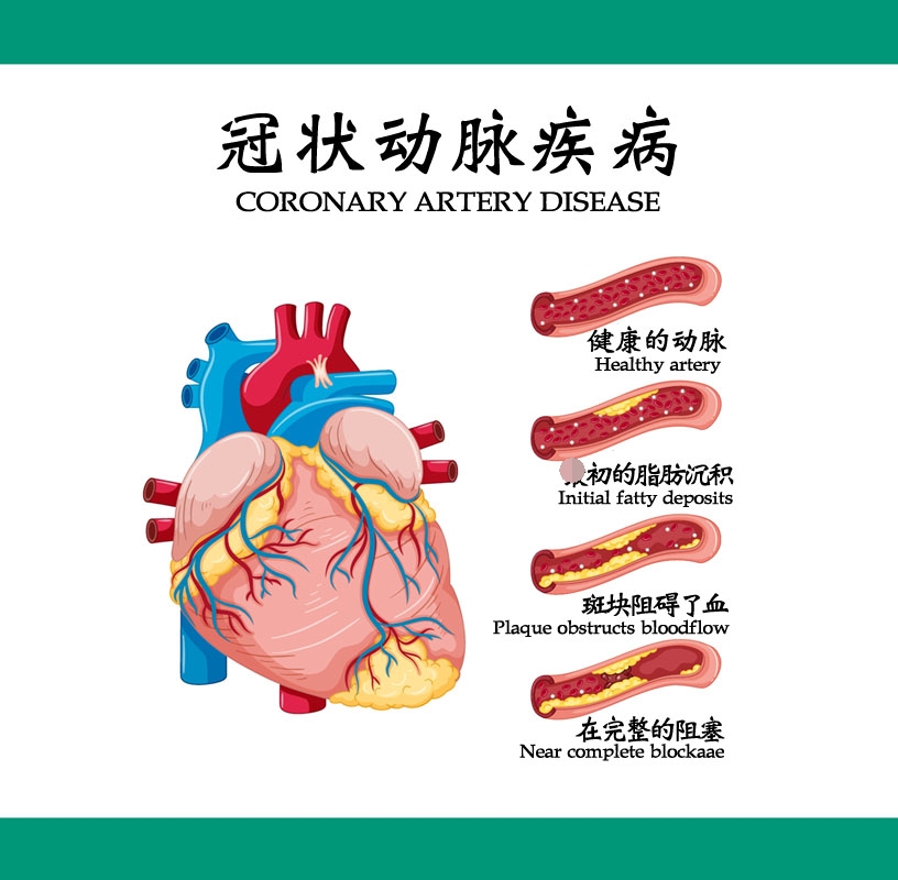 心脏冠脉血管解剖图图片