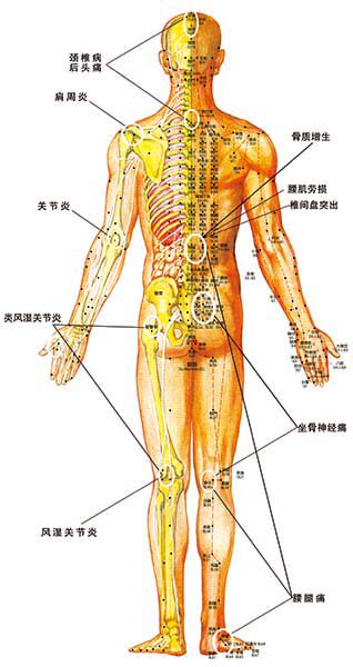 569海报印制海报展板素材11人体背视穴位图 (非高清图)