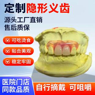 假牙定制隐形义齿树脂活动假牙隐形门牙假牙义齿活动牙种植临时牙