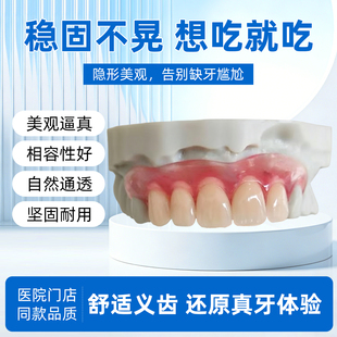 定制隐形弹性义齿树脂活动假牙隐形门牙假牙活动性义齿种植临时牙