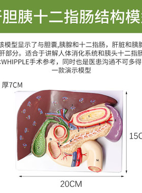 仿真胰脾肝胆十二指肠浮雕模型