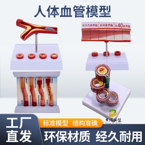 教学仿真人体病理血管堵塞动支脉粥样硬化心血管模型堵塞程度变化 - 封面
