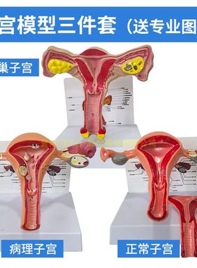 黄和卵巢子宫模型生殖解剖教学