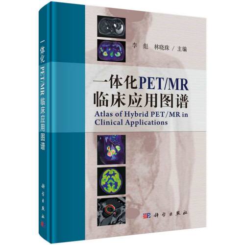 一体化PET\MR临床应用图谱(精)