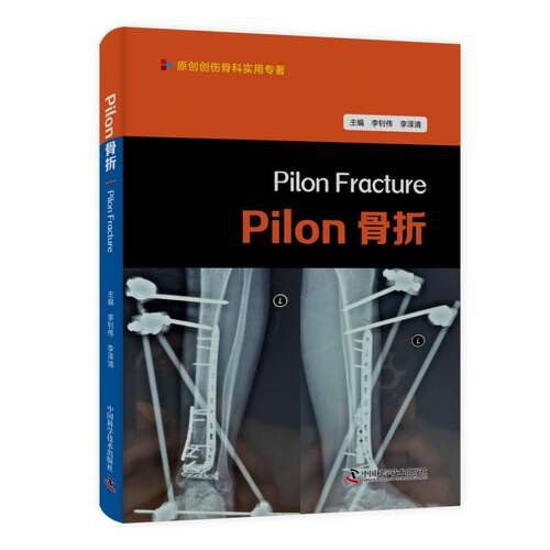 Pilon骨折