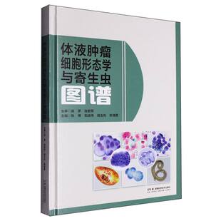 体液肿瘤细胞形态学与寄生虫图谱