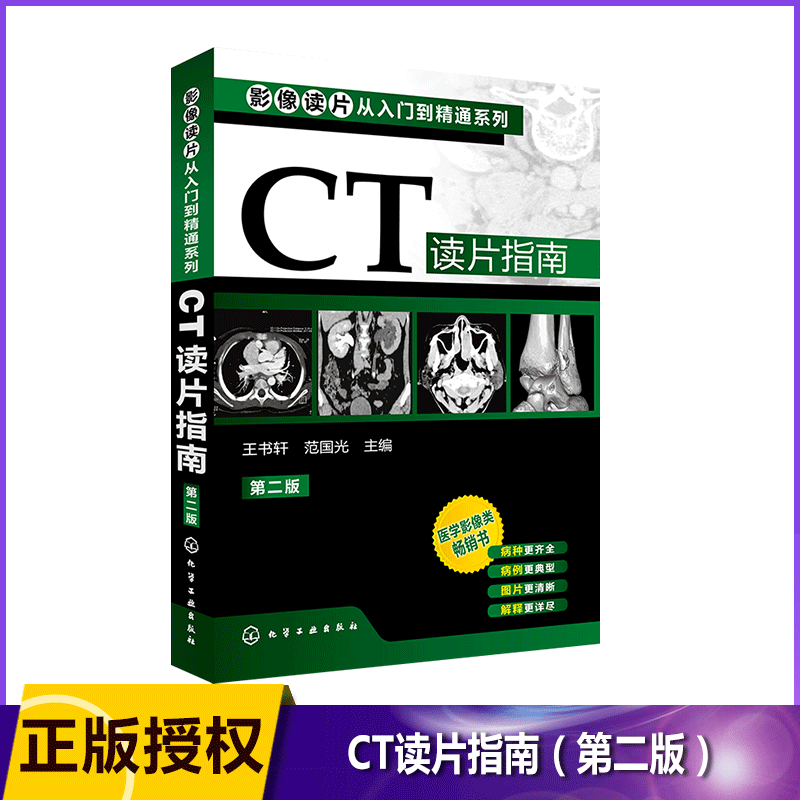 CT读片指南(第2版)/影像读片从入门到精通系列 医学影像类 影像诊断新手学习经验  影像专业知名教授给基层影像医师的参考书