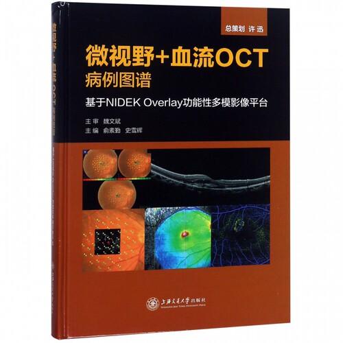 微视野+血流OCT病例图谱(基于NIDEK Overlay功能性多模影像平台)(精)