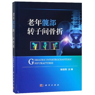 老年髋部转子间骨折 精