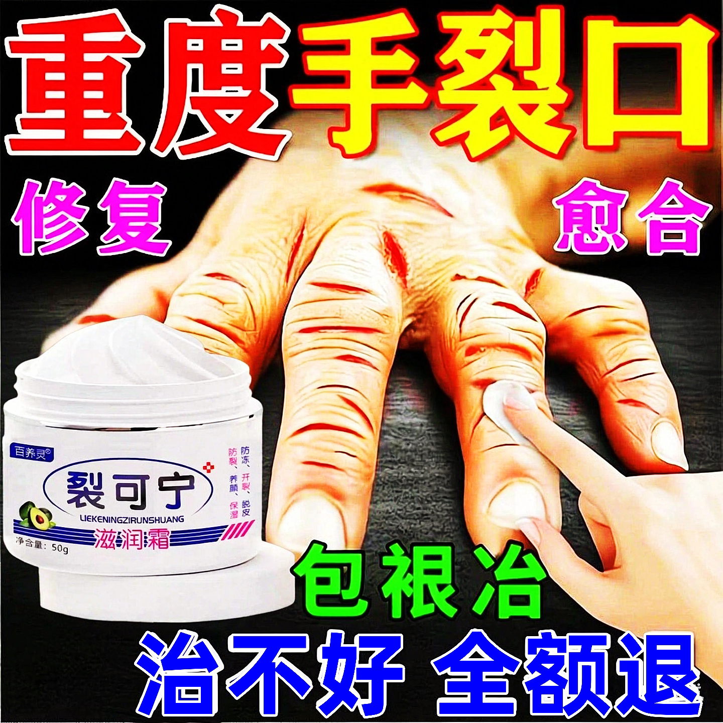 裂可宁护手修复霜脚后跟干裂起硬皮足跟开手足裂皲裂膏正品
