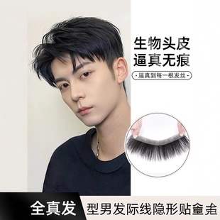 雅悦男士前额发际线假发贴全真发轻薄无痕M型额头生物头皮隐形刘