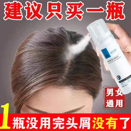 头皮干燥起皮补水喷雾毛囊深层清洁护理营养液去油屑保湿滋养精华