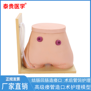 TG/H38高级瘘管造口术护理模型结肠回肠瘘口术后管饲护理灌肠排便