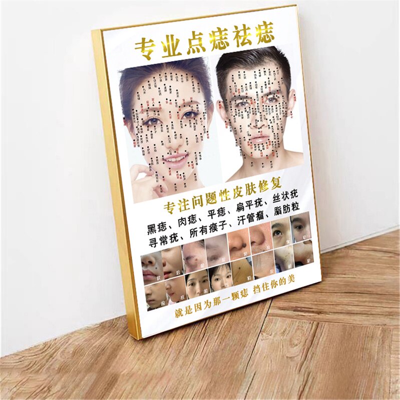 面部美容点痣祛斑解析图挂画男女面痣图海报纹绣宣传广告墙壁装饰