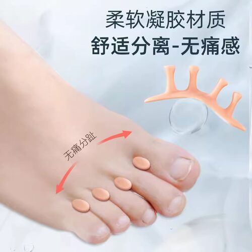 重叠脚趾分离矫正分趾器