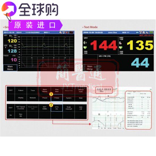 TFT液晶触摸屏显示器胎儿心跳监护仪FC1400
