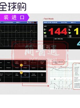TFT液晶触摸屏显示器胎儿心跳监护仪FC1400