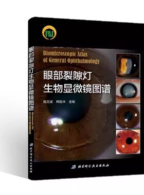 眼部裂隙灯生物显微镜图