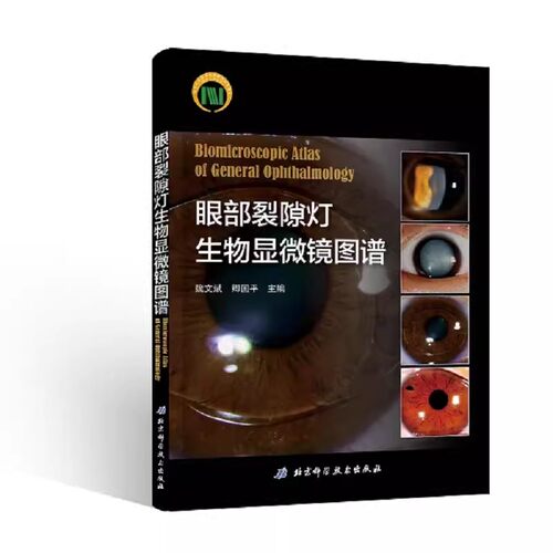 眼部裂隙灯生物显微镜图