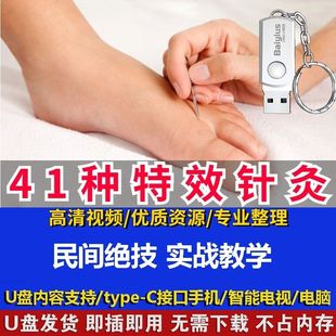 针灸绝技41种特效疗法教程视频中医针灸临床实操学习资料U盘