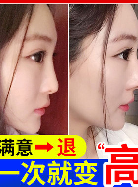【小红书推荐 美鼻神器】告别丑鼻子精油变高山根鼻梁精华液挺鼻