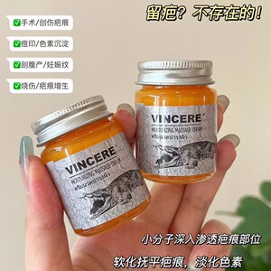 泰国原装正品vincere鳄鱼膏淡化痘印去疤修复淡斑妊娠纹冻疮