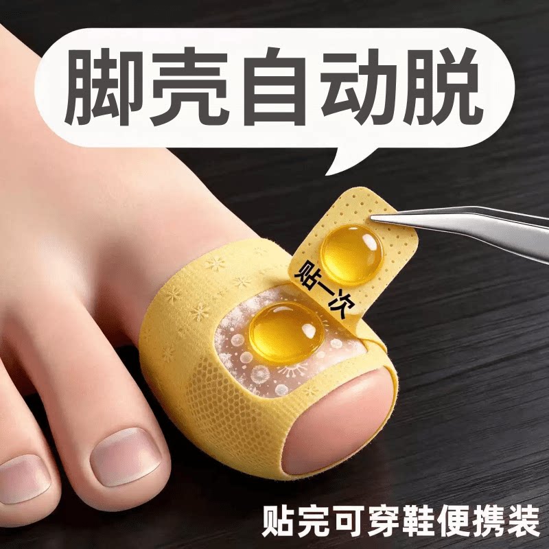 【国药热销】专用净甲除指甲贴植物萃取正品脚趾手指甲通用