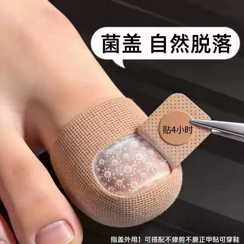 【国药热销】专用净甲除指甲贴植物萃取正品脚趾手指甲通用