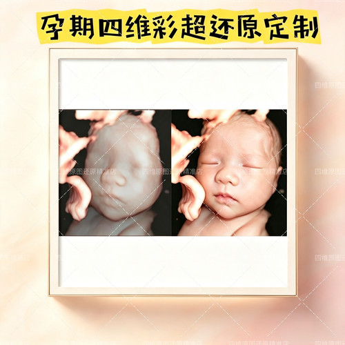 宝宝四维彩超相框冰箱贴定制孕期三维五维3D打印还原成长纪念摆台