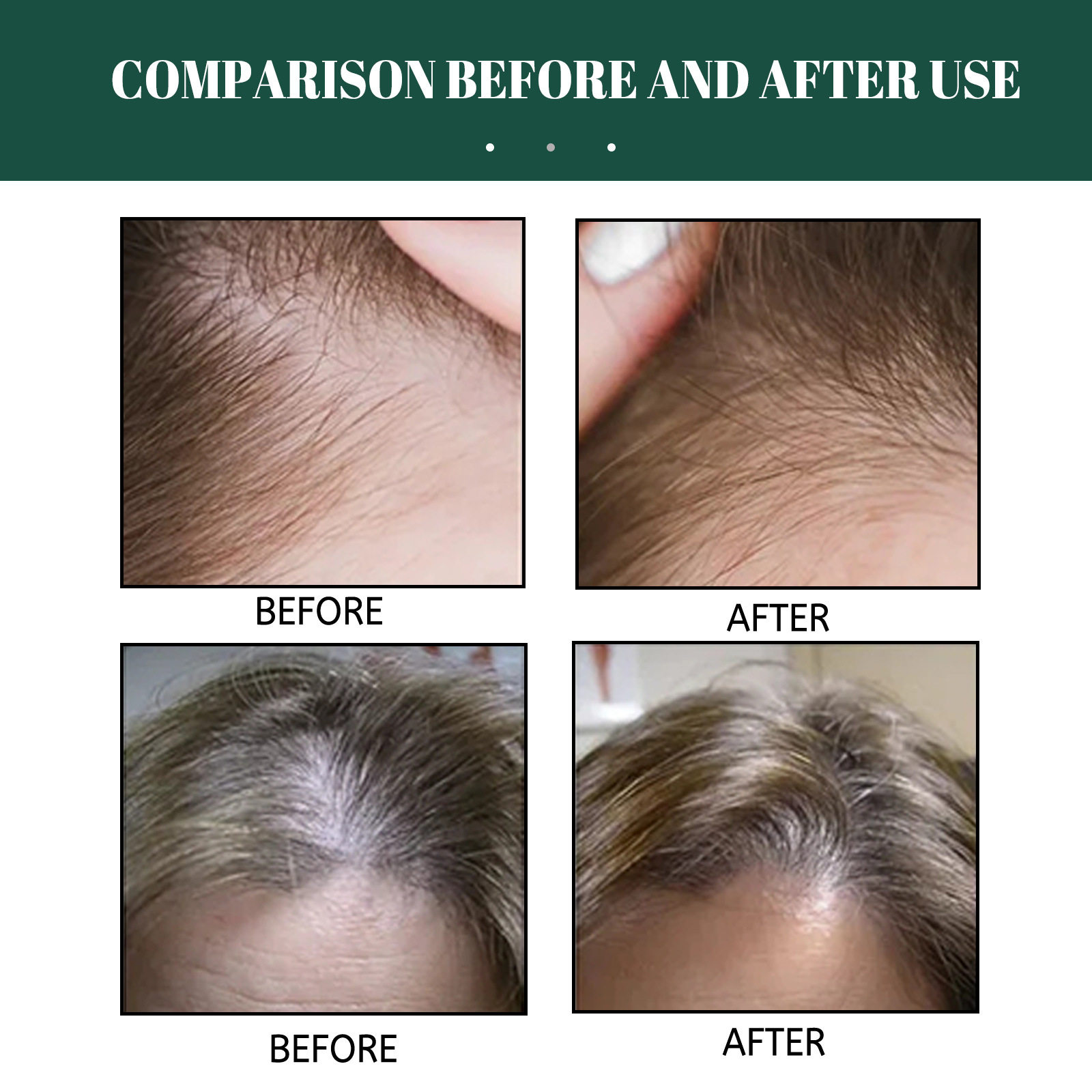 ouhoe生姜头发增长喷雾 滋润秀发防掉固发护发促进头发增长喷雾