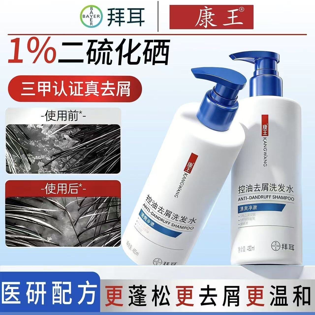 康王去屑止痒控油清爽二硫化硒洗发水洗头清洁温和蓬松易冲洗中泡