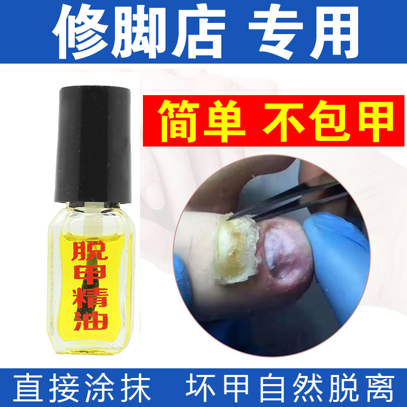 灰指甲专用液软甲脱甲膏去顽固增厚型水抑菌冰醋酸治疗脱甲精油
