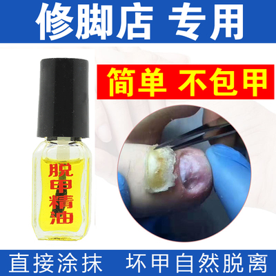 顽固增厚型水抑菌精油脱甲膏