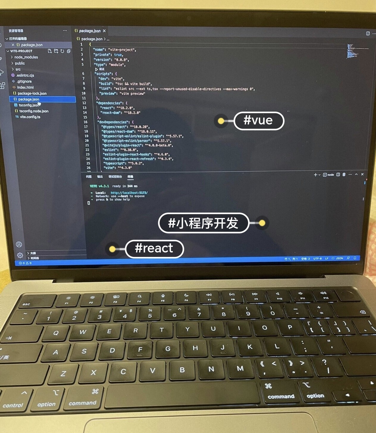 个人】web网页设计制作html静动态网站js，css，html，vue，react图片