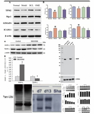 个人Wb条带/westernblot/趋势定制/实验制作/科研蛋白检测/跑条带
