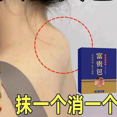 富贵包正品消除贴颈椎驼背疏通按摩非矫正器按摩仪艾灸颈椎贴神器