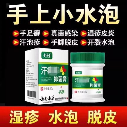 真菌感染手气手上起小水泡云南本草汗孢疹汗泡珍疱疹药膏止痒汉状