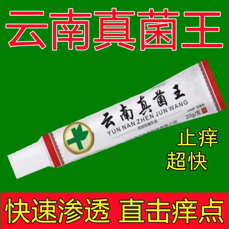 云南真菌王快速止痒皮肤瘙痒外用蚊虫全身干痒皮肤瘙痒止痒抑菌膏,保健用品,皮肤消毒护理（消）,淘宝优惠券,粉丝福利购,淘宝优惠卷