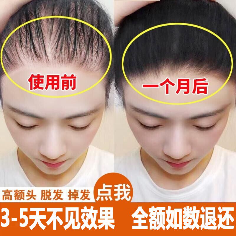 采菲尔集羽名萱洗发水防脱蓬松控油生发变黑发去屑止痒增密官方旗