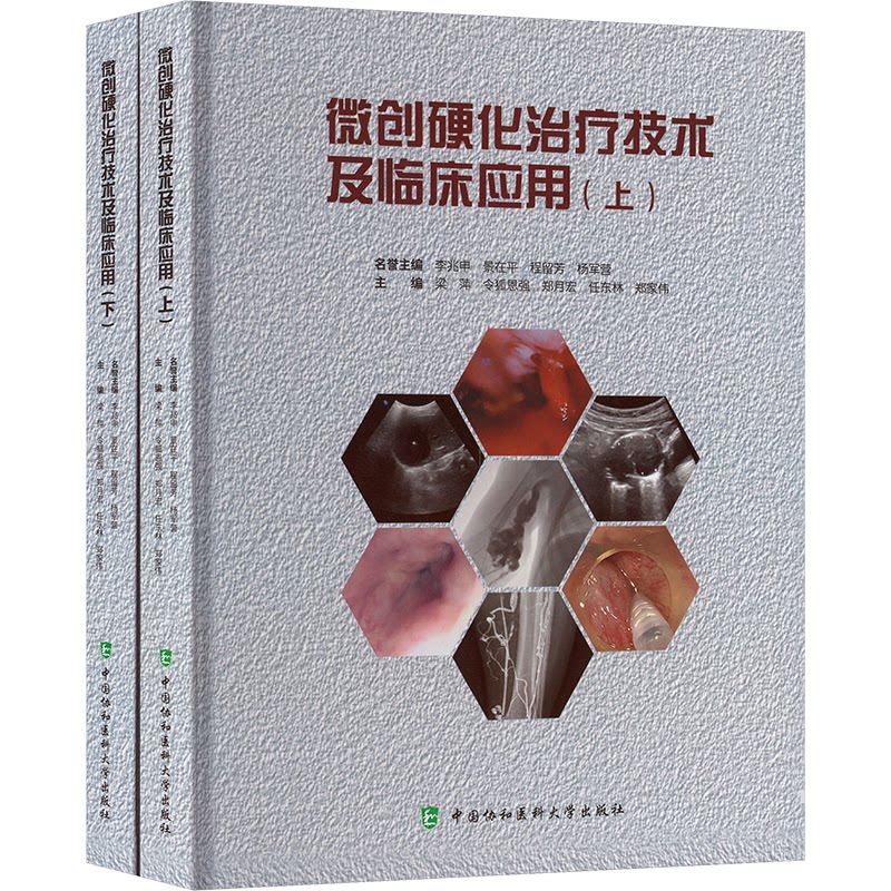 【官方正版】 微创硬化治疗技术及临床应用 梁萍等主编 中国协和医科大学出版社 9787567924475