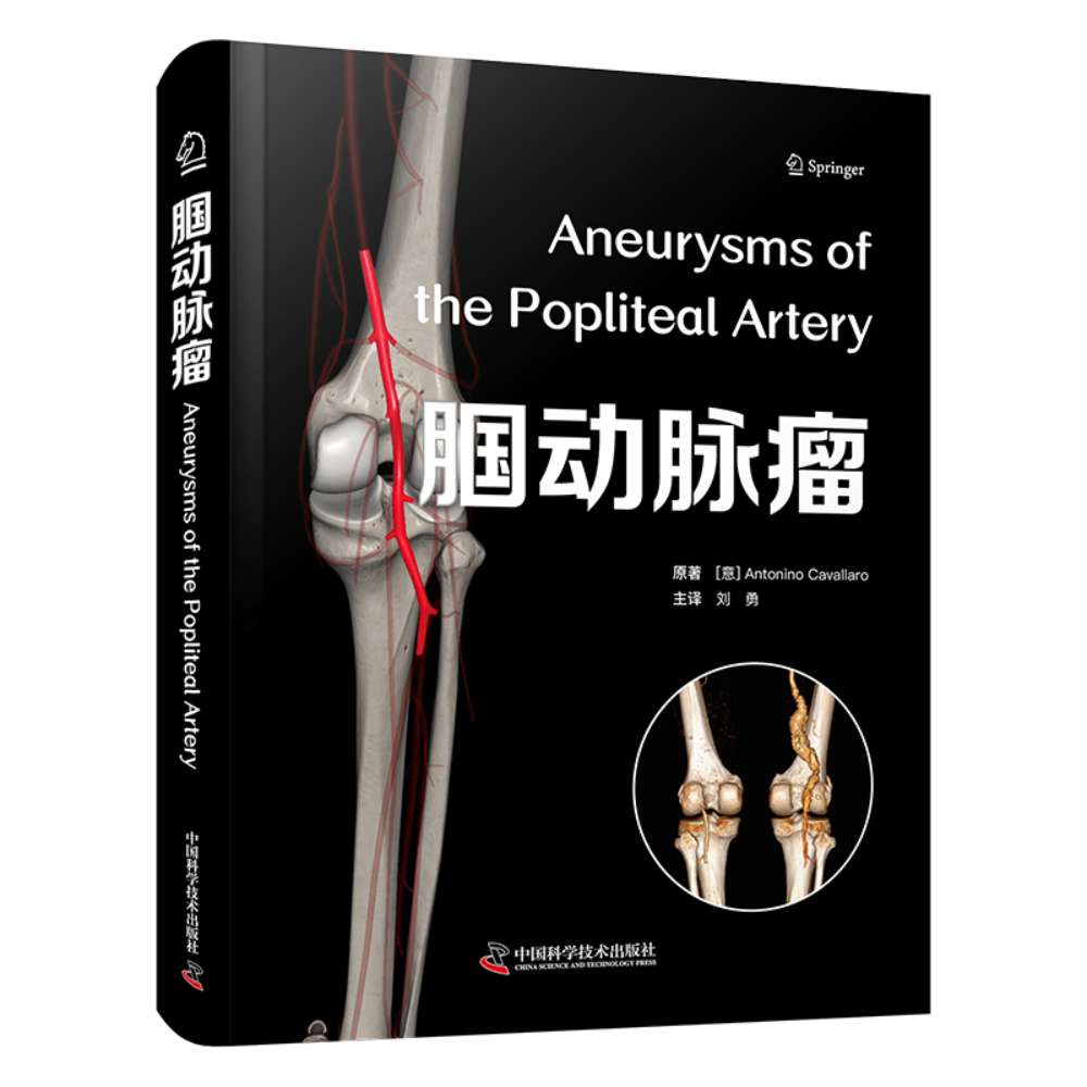 【官方正版】 腘动脉瘤 国际经典血管外科学译著 9787523610671 [意]安东尼诺·卡瓦拉罗,[Antonino,Cavallaro]著，刘勇 译