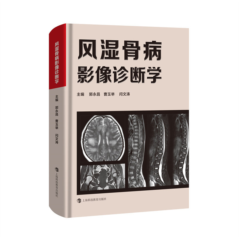 【官方正版】 风湿骨病影像诊断学 9787542881342 主编郭永昌, 曹玉举, 闫文涛 上海科技教育出版社