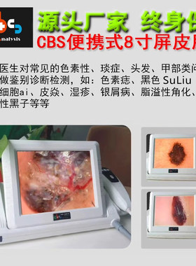 cbs便携式分析仪皮肤镜