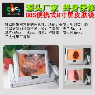cbs便携式分析仪皮肤镜