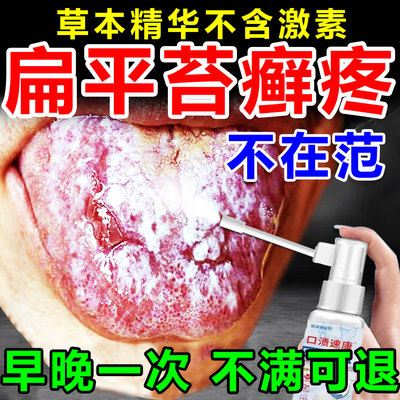 口腔扁平苔藓专用黏膜修复口腔反复白斑糜烂纤维化喷剂药