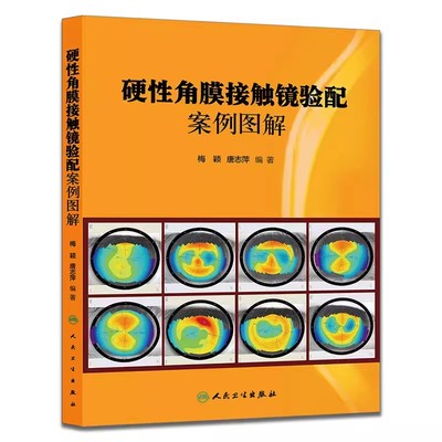 正版硬性角膜接触镜验配案例图解 梅颖 人民卫生出 眼科学验光师角膜地形图眼科书 眼镜设备验光配镜书视光学眼视光器械学书籍