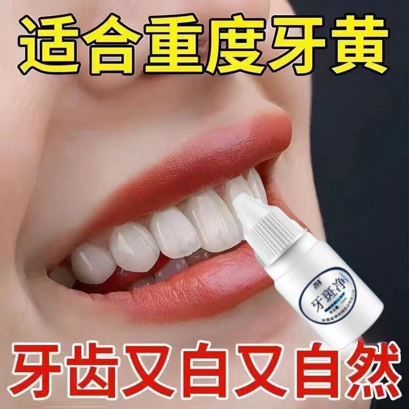洁牙粉牙齿美白速效去黄牙黑斑去烟渍洗牙污垢茶渍牙菌斑祛除神器
